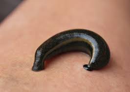 Leech on skin